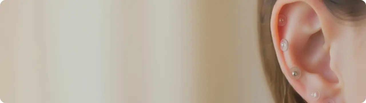 Auriculoterapia – Servicio Nuhsa